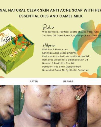 Etenal Clear Skin Natural Soap