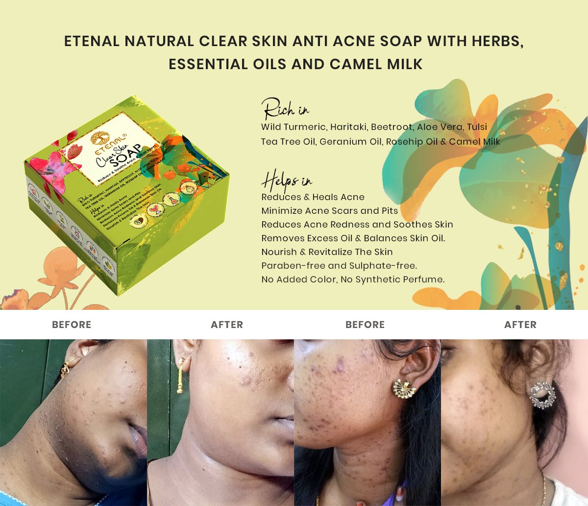 Etenal Clear Skin Natural Soap